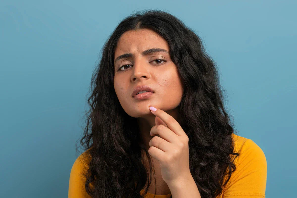 Young woman examining acne breakout, representing skincare treatment with Azelaic Acid cream.