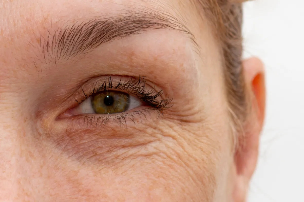 Close-up of eye wrinkles on mature skin showing signs of aging before using copper peptide GHK-Cu serum