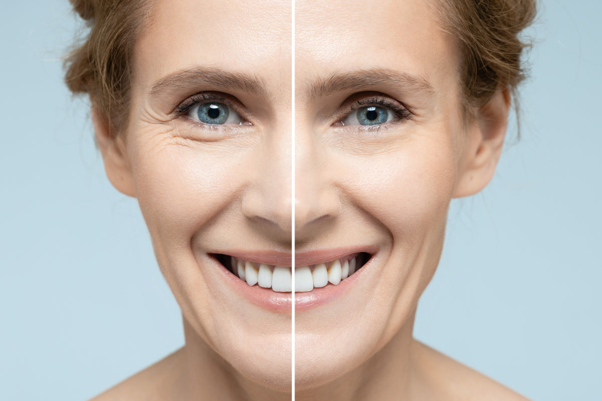 Before and after effects of using encapsulated retinol serum, reducing fine lines and wrinkles.