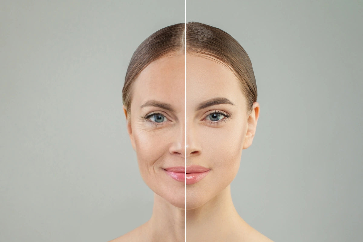 From Fine Lines to Fullness - The Anti-Aging Miracles of Hyaluronic Acid