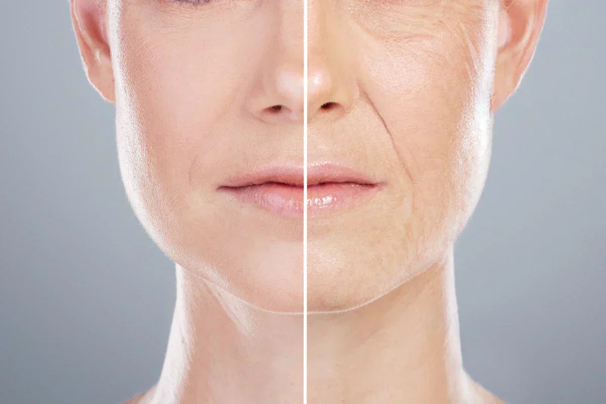 Before and after comparison showing reduction of wrinkles and rejuvenated skin from copper peptides