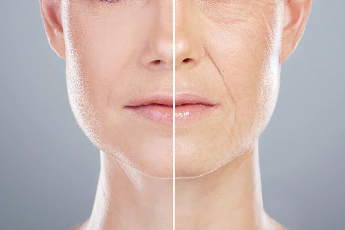 Before and after comparison showing reduction of wrinkles and rejuvenated skin from copper peptides