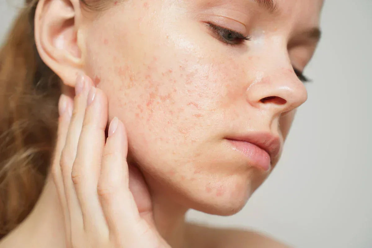 Encapsulated Retinol for Formulators: Stability, Controlled Release, Irritation Reduction, R&D and Anti-Ageing Formulation Guide
